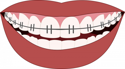 orthodontics 3109763_640 1